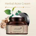 Réparer l&#39;acné crème à base de plantes Anti-taches traitement de l&#39;acné cicatrice crème points noirs rétrécir les pores OEM crème pour le visage fabrication